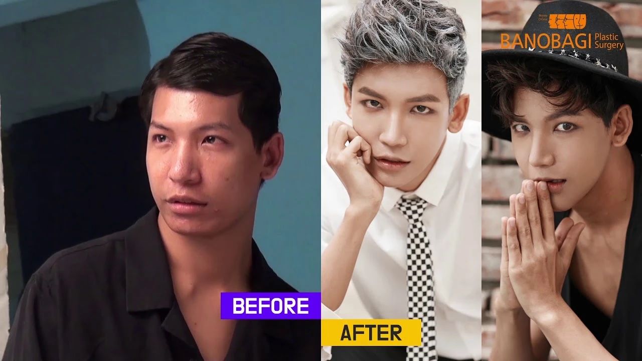 泰国最逆天的不是变性，而是堪比换头的整形