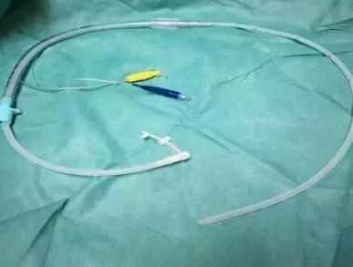 胃管导丝拔不出来什么原因,胃管拔不出来怎么回事