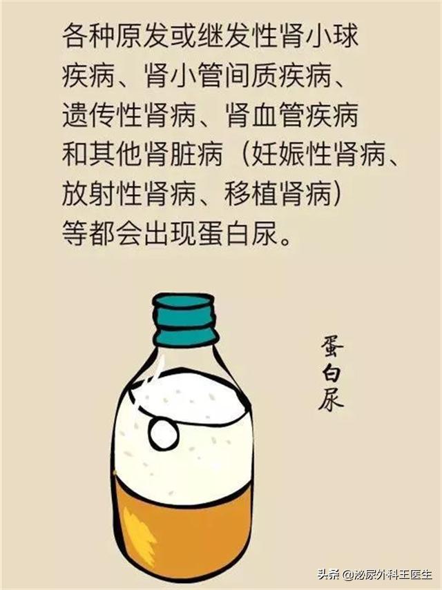 泡沫尿属于蛋白尿吗,泡沫尿是蛋白尿嘛