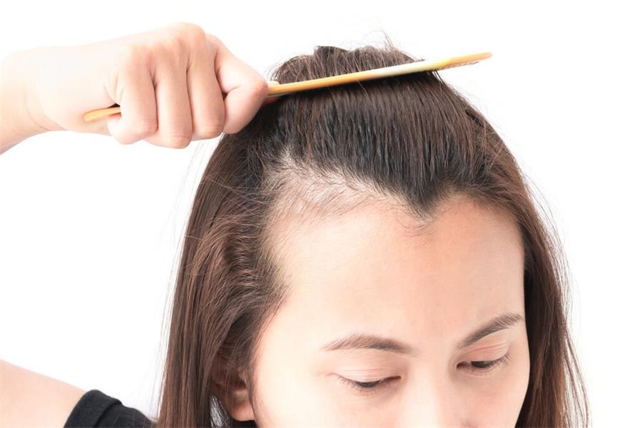 哺乳期妈妈脱发严重怎么办,哺乳期脱发怎么办最快速恢复