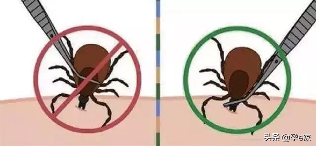 身上出现许多小黑痣,身上出现凸起黑痣一定要重视