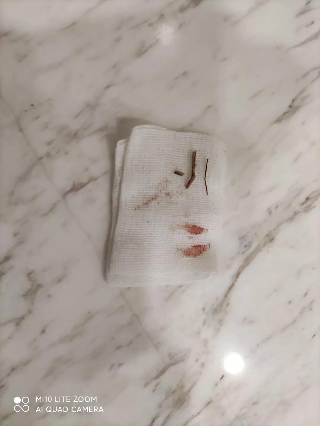 狗狗颈部有个包块是正常的吗,狗狗下巴有肿块用什么药治疗