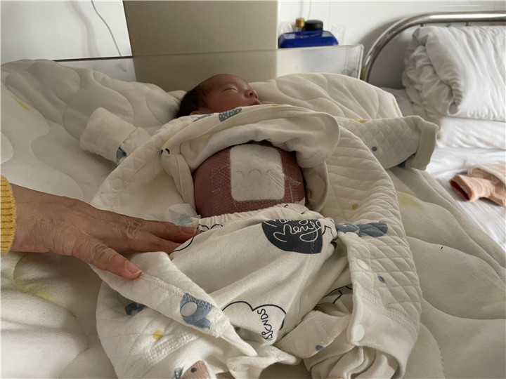 怀孕肚皮表面撕裂生完是怎么样的,胎儿肚皮开裂