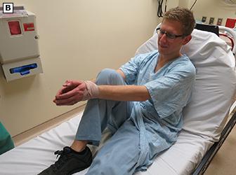 肩膀脱臼了？有一种新方法，能让你自己复位回去，像“陈真”一样