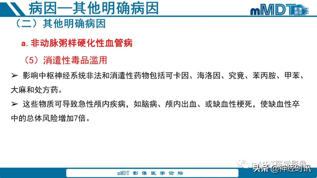 急性缺血性脑卒中ppt素材图片,青年缺血性脑卒中ppt