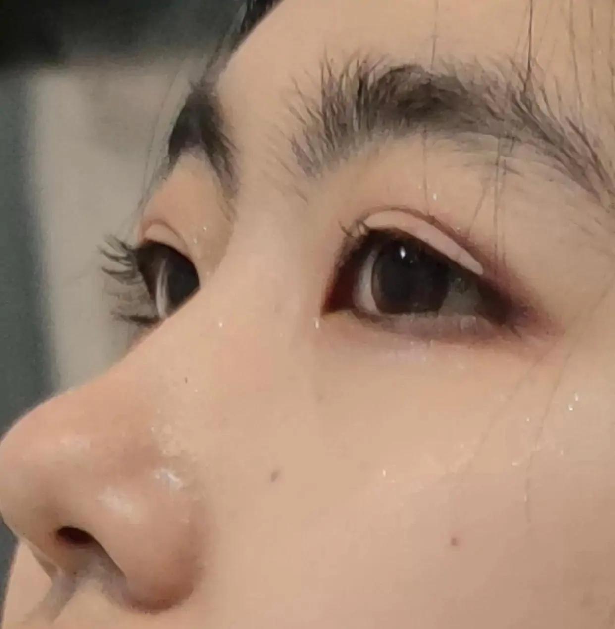 单眼皮垂眼怎么拯救,单眼皮怎么拯救