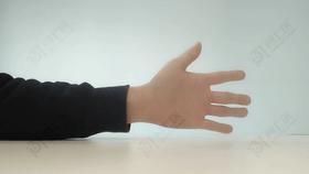 用手机大拇指腱鞘炎能自愈吗,长时间玩手机手腕腱鞘炎的案例