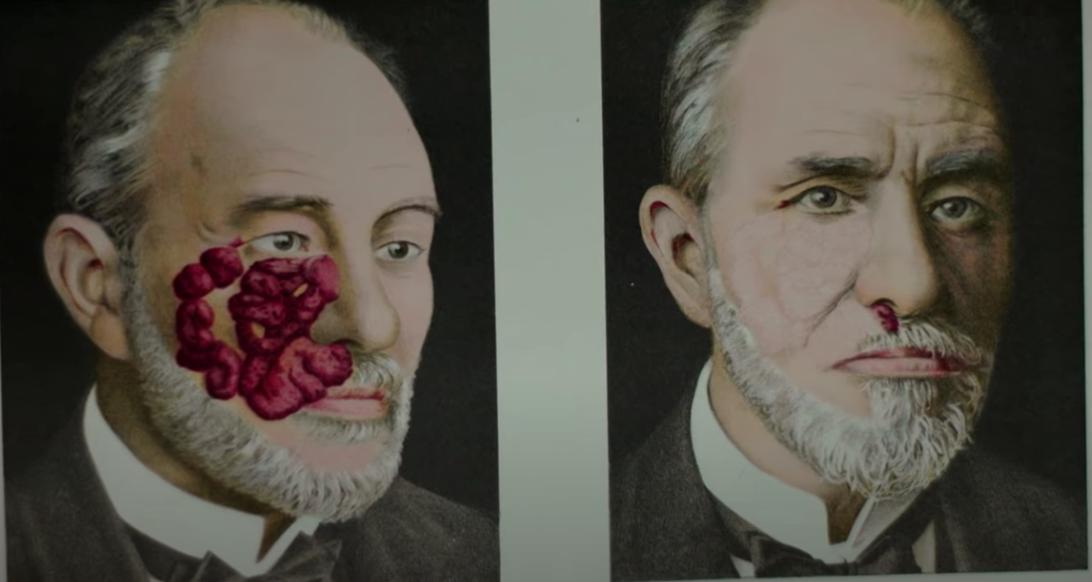 牙齿烂光,脸长巨瘤,骨头还会发光,被美国资本家逼向绝路的女工