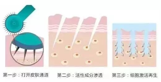 洁面仪可以代替美容仪吗,洁面仪好还是美容仪好