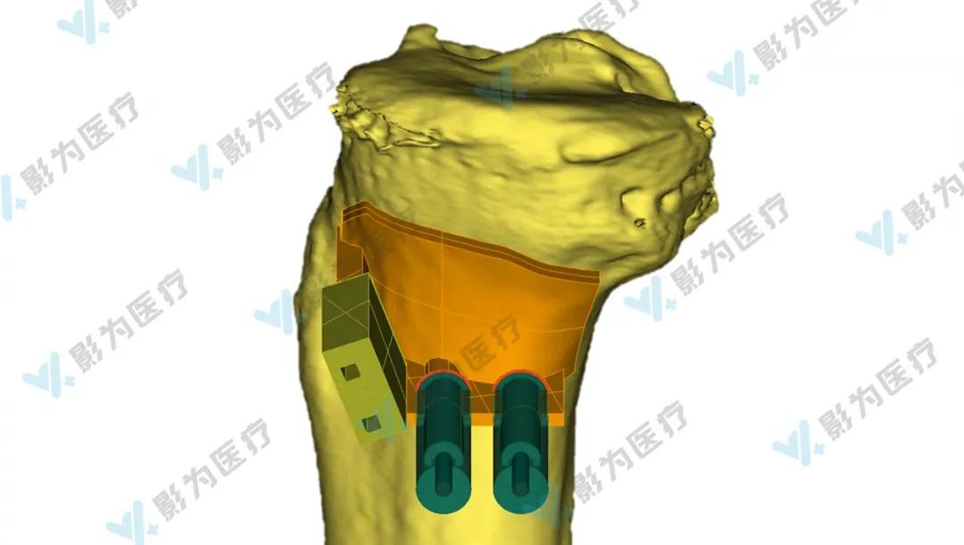 安医大阜阳附属医院减重,阜阳市颍州区安医大附属阜阳医院