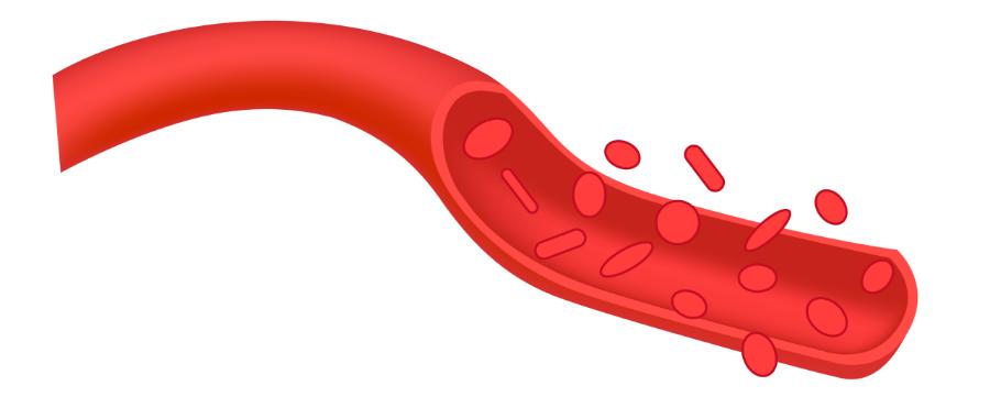 朱迅生病真相揭秘,朱迅艾灸