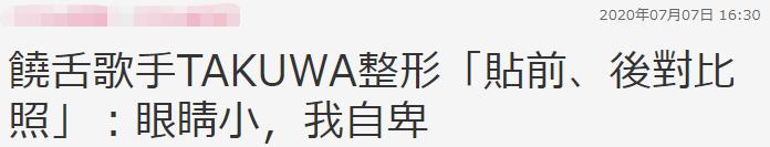 韩国明星男整容对比,韩国男明星整容疑似失败