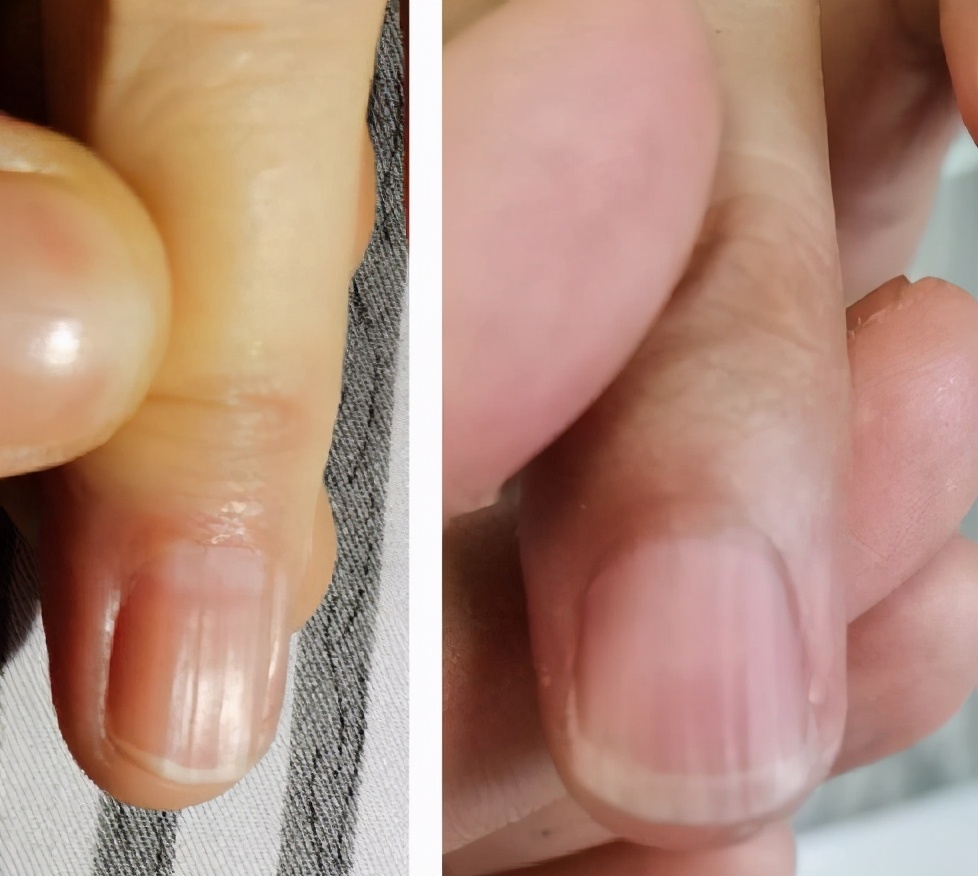 阿胶补气补血配方,阿胶固元膏补血吗