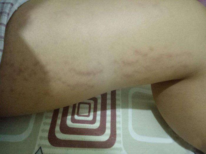 生没生过孩子，一眼就能看穿，尤其这3个部位，稍不注意就会暴露