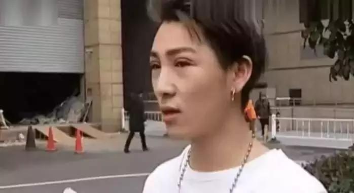 男生割内双眼皮手术,男子去割单眼皮后的结果