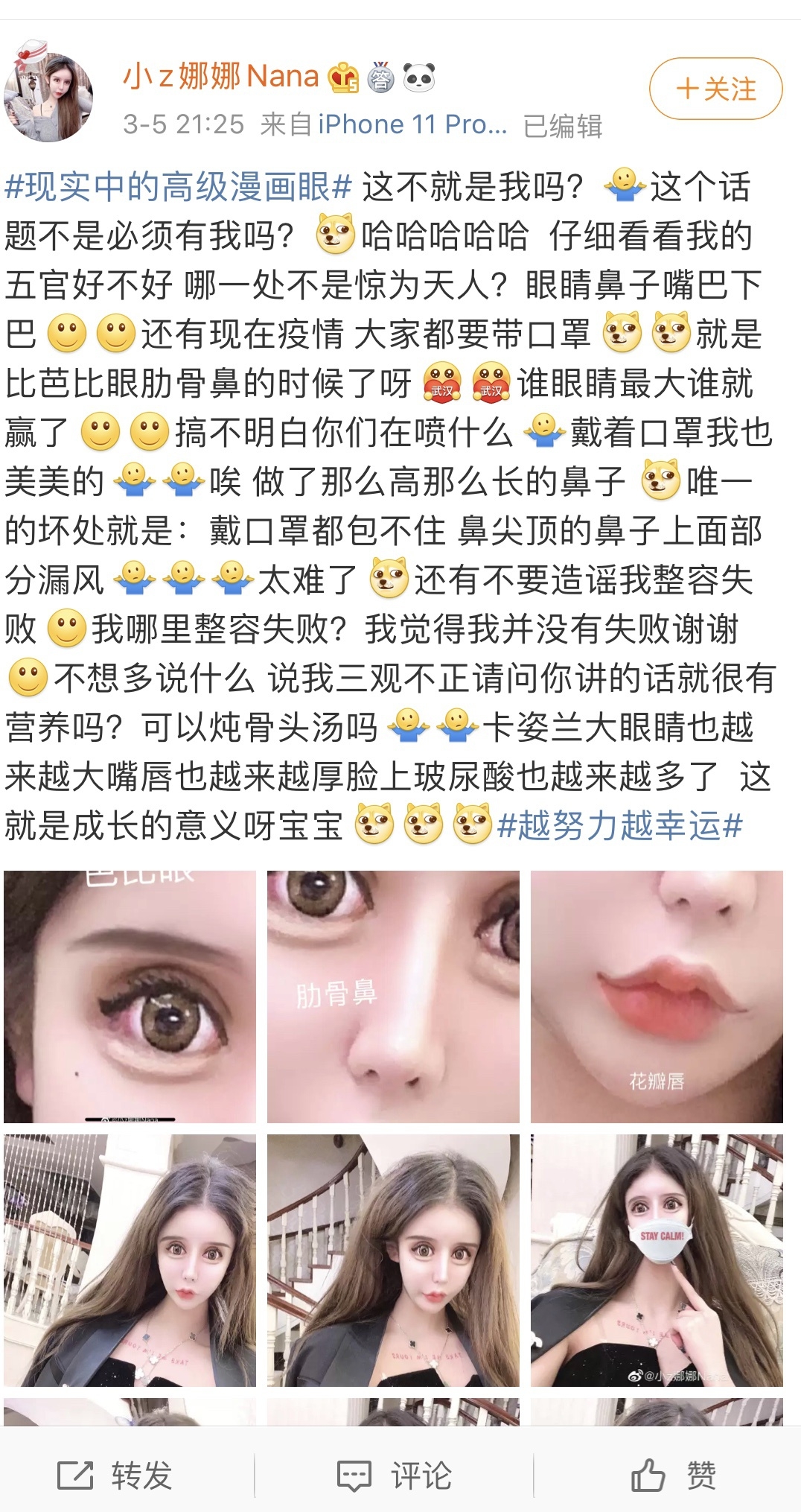 导演为什么不让演员整容,为什么导演不喜欢整容的演员