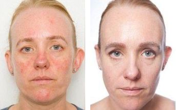 网红抗老面霜,35款网红修护霜