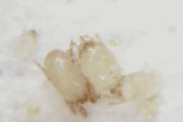 不用洗床单晒被子怎么除螨虫,螨虫去除妙招不用花露水