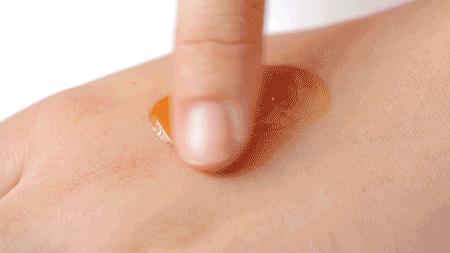 战痘神器祛痘效果怎么样,战痘神器推荐