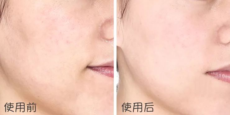 澳洲绵羊油娇嫩补水保湿霜,澳洲高颜值绵羊油