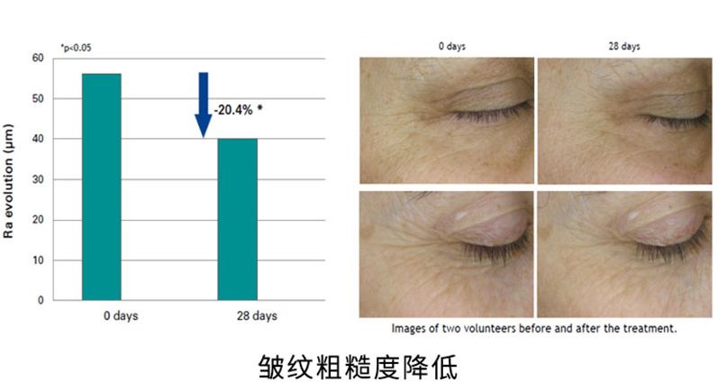 韩国牌子眼霜抗老去皱保湿,韩国平价眼霜精华全脸用的