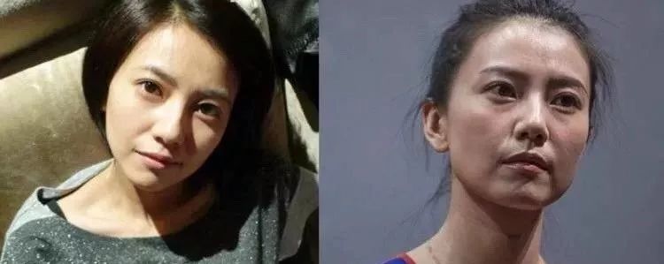 马应龙八宝眼袋型眼膜,马应龙八宝多肽眼膜