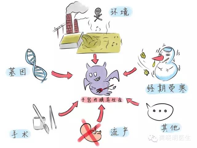 子宫内膜异位症——痛经的一种常见病因