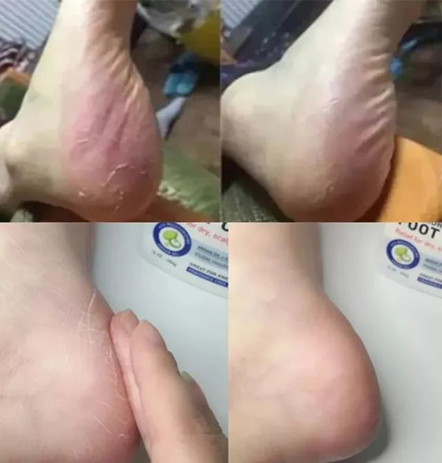 秋冬补水保湿明星产品推荐,补水保湿夏季国货好物