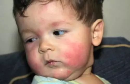 如何清洗衣领上的顽固黄渍,娃的衣领污渍怎么才能洗干净