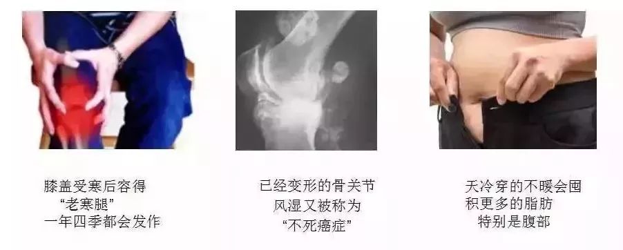 有北极熊绒毛的衣服吗,有了羽绒服不会冷了