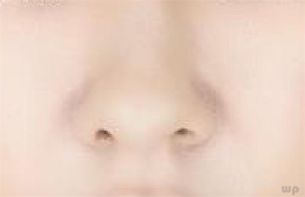 鼻子上的毛孔挤出黄色的颗粒,鼻子毛孔凸起的小疙瘩