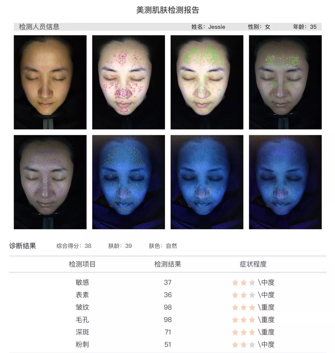 灏忚寕鑲岃瘖瀹ゅ埌搴曟湁澶氬己,灏忚寕鑲岃瘖瀹よˉ姘村悧