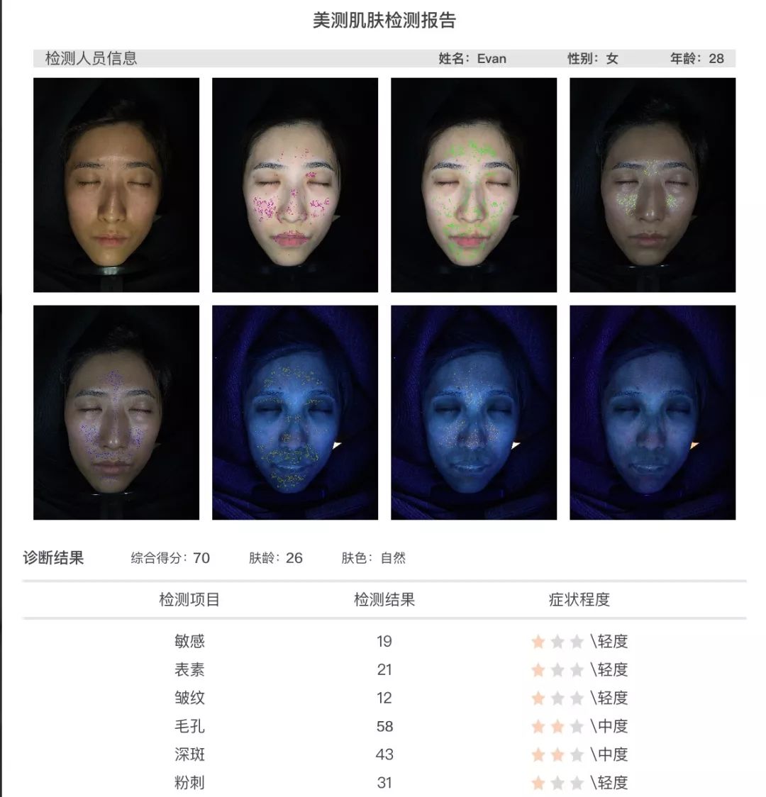 灏忚寕鑲岃瘖瀹ゅ埌搴曟湁澶氬己,灏忚寕鑲岃瘖瀹よˉ姘村悧