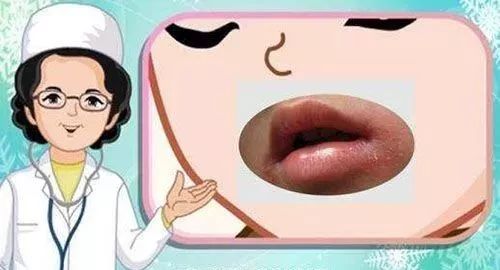 药店里几毛钱的药膏,竟能缓解治疗12种常见病痛!不看亏大啦~