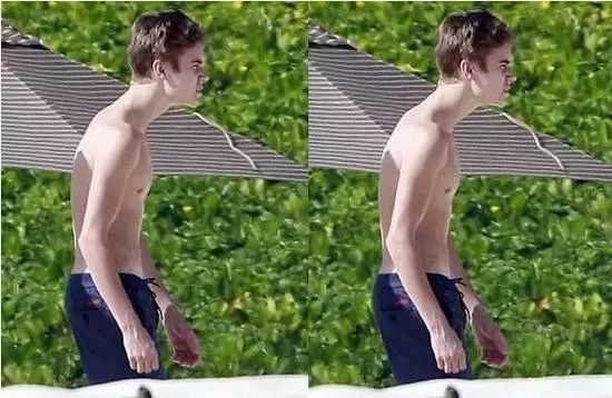 防驼背矫正神器步骤,纠正驼背神器视频