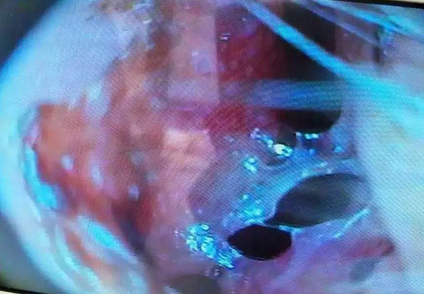 四退原则出炉：“无论什么原因，鼻炎治不好就退款！”常州这家诊所打了谁的脸？