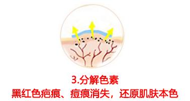 斑疤痘敏妊娠纹,伤痕印如何能快速消除