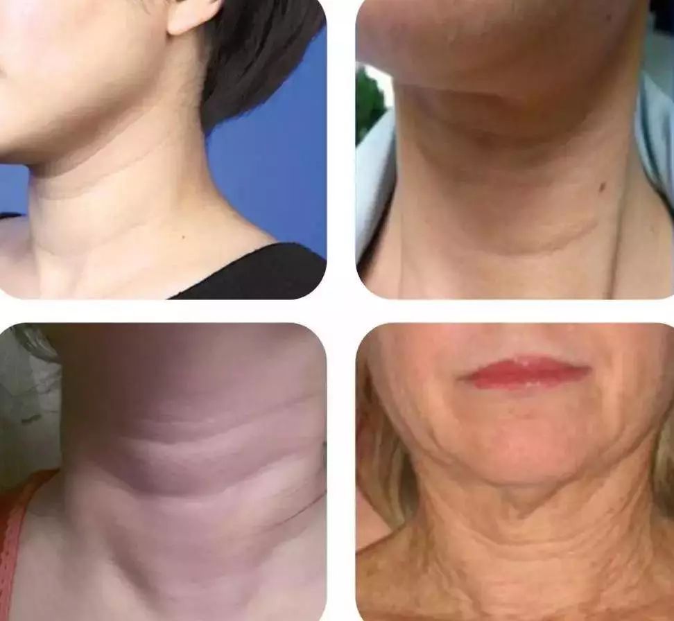 閰嶅ザ濂惰￥澶栧,杩囧勾濂跺ザ澶栧