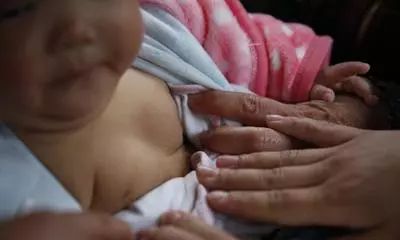 14个月女孩乳房发育！医生却说不用治疗？！