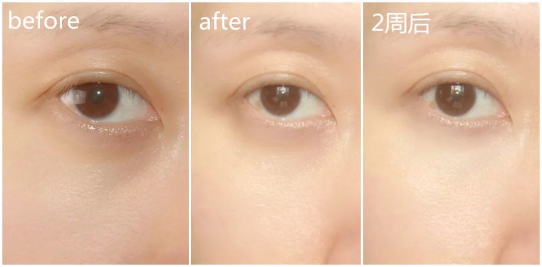 兰蔻明星大红瓶,兰蔻彩妆明星同款产品有哪些