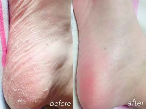 呵护手足|戴手套=精油SPA？还不耽误玩手机？30分钟急救手膜足膜，死皮老茧全消失，让你从头嫩到脚