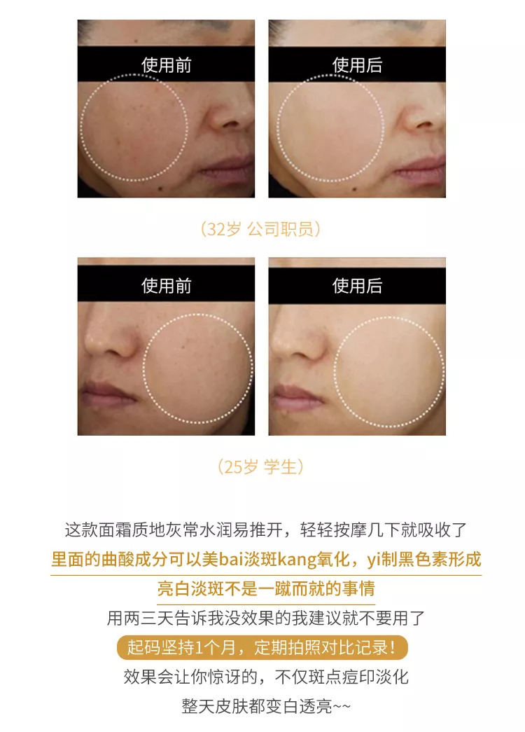 韩国东星祛斑霜琅丝曲酸面霜测评,东星祛斑霜适合的肤质