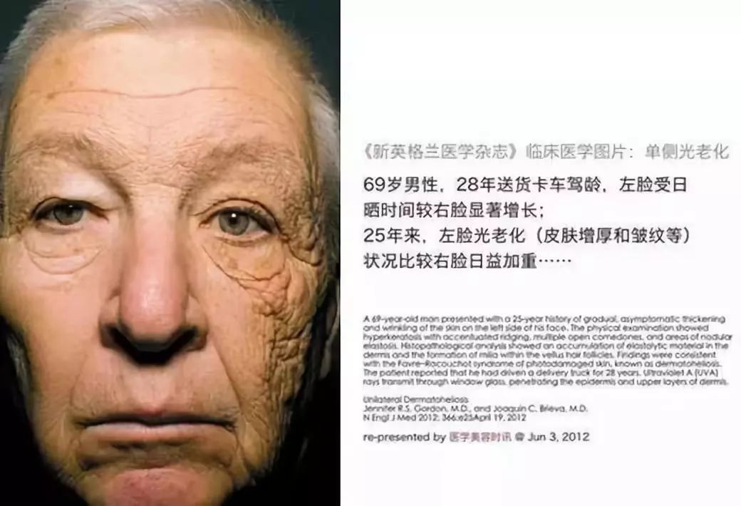 错过福利价格翻几倍,错过一波红利期