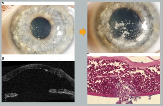 孙旭光眼科医生,孙旭光大夫角膜塑形镜危害