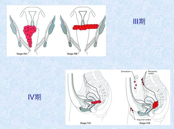 女生对不起我错了的视频,女生说对不起是我的错