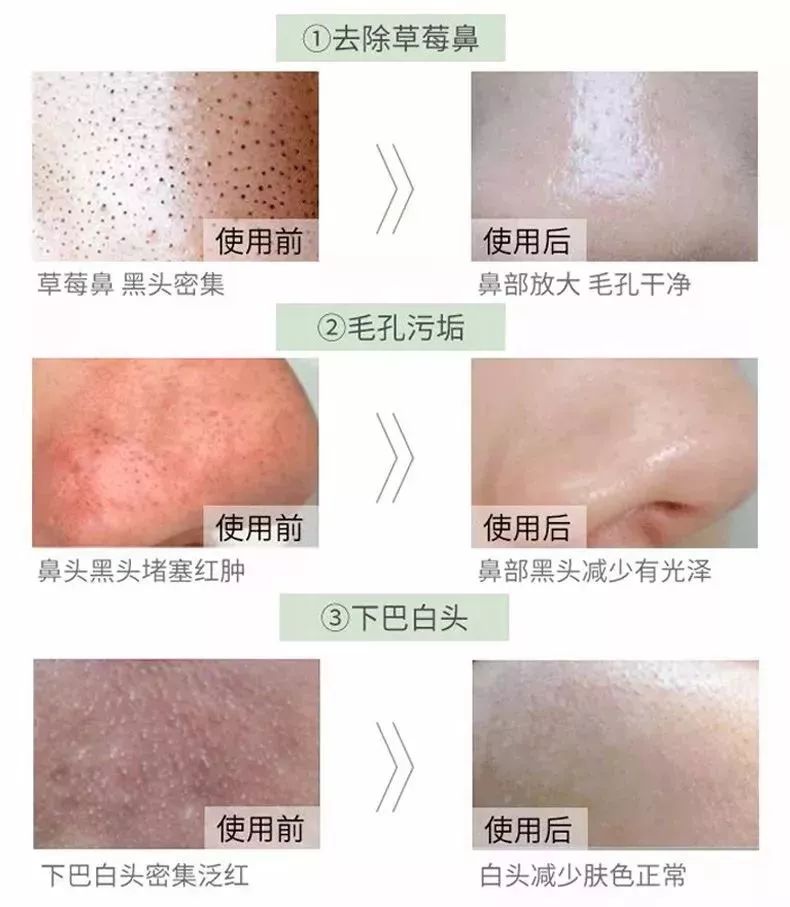 人脸上螨虫的数量,人脸上有多少螨虫