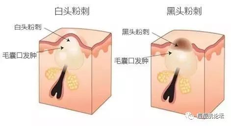 磨人的小妖精配图,磨人的小妖精脸