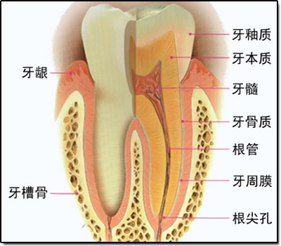 牙根折断了怎么补救,牙根折断多深可以保留