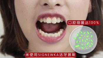 闭着嘴巴一会就干有异味,闭着嘴巴都感觉口腔有异味