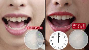 闭着嘴巴一会就干有异味,闭着嘴巴都感觉口腔有异味